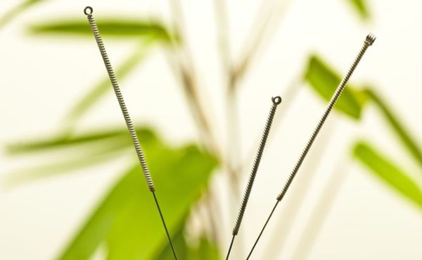 Why do Acupuncturists fail at business?